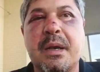 Vítima de xenofobia, brasileiro é espancado por homem em Portugal