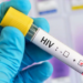 A volta do HIV: Um desafio para a nova geração