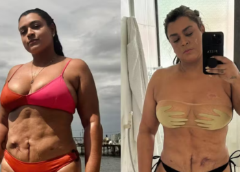 Após consulta nos EUA, nova cirurgia de Preta Gil para retirar tumores é adiada