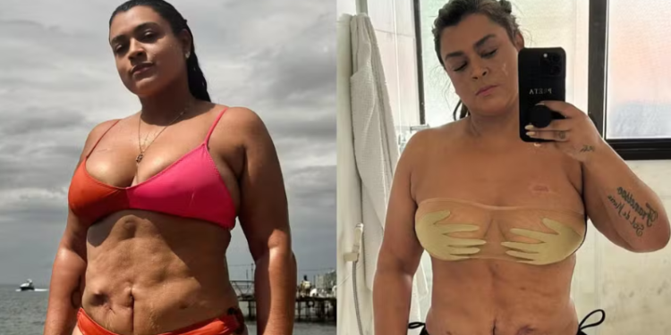 Após consulta nos EUA, nova cirurgia de Preta Gil para retirar tumores é adiada