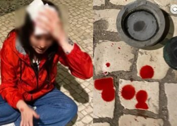 “Fala baixo sua vaca”: brasileira leva pedrada na cabeça atirada de prédio por um homem no Porto