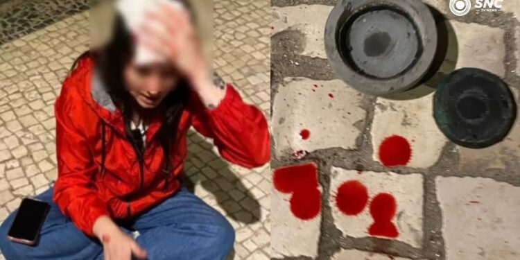 “Fala baixo sua vaca”: brasileira leva pedrada na cabeça atirada de prédio por um homem no Porto