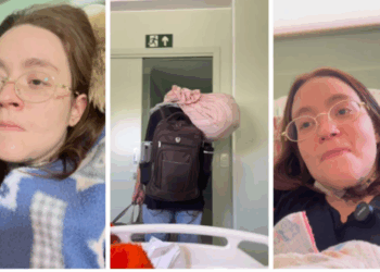 Mineira com neuralgia do trigêmeo, a “pior dor do mundo”, recebe alta após coma que ajudou a aliviar sofrimento